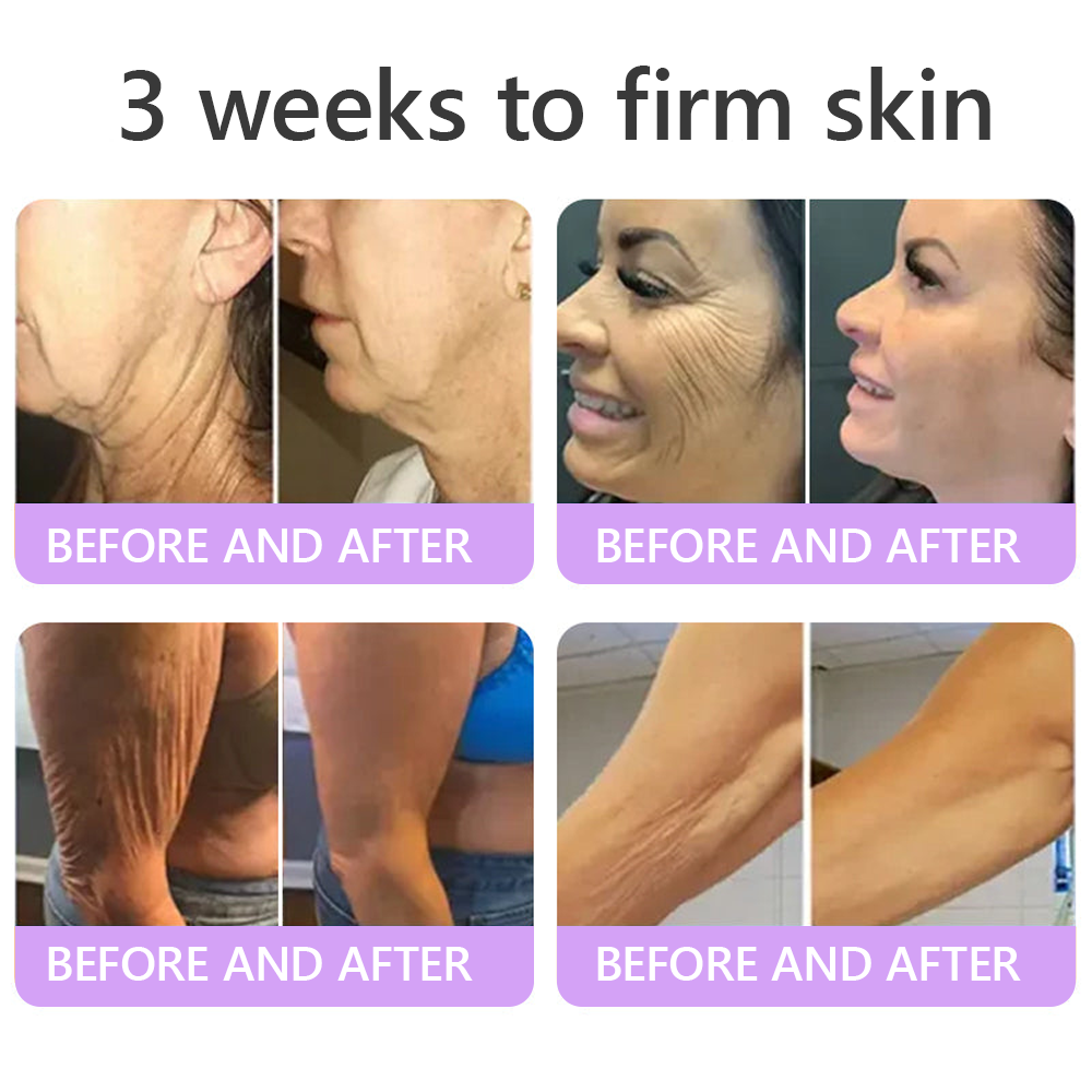 50% discount: Yovot® PDRN Multi-Peptide Massaging Body Roller Cream