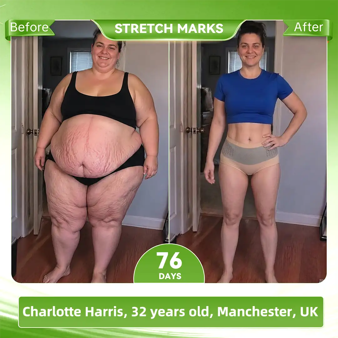 𝐀𝐤𝐲𝐠𝐨® 𝟐𝟎𝟐𝟔 𝐌𝐨𝐫𝐢𝐧𝐠𝐚 x 𝐁𝐞𝐫𝐛𝐞𝐫𝐢𝐧𝐞 x 𝐍𝐀𝐃+ 𝟔-𝐈𝐧-𝟏 𝐌𝐢𝐜𝐫𝐨-𝐏𝐚𝐫𝐭𝐢𝐜𝐥𝐞 𝐒𝐜𝐮𝐥𝐩𝐭𝐢𝐧𝐠 & 𝐅𝐚𝐭-𝐁𝐮𝐫𝐧 𝐒𝐡𝐨𝐫𝐭𝐬 (Women + Men with Enhanced Male Vitality Blend)