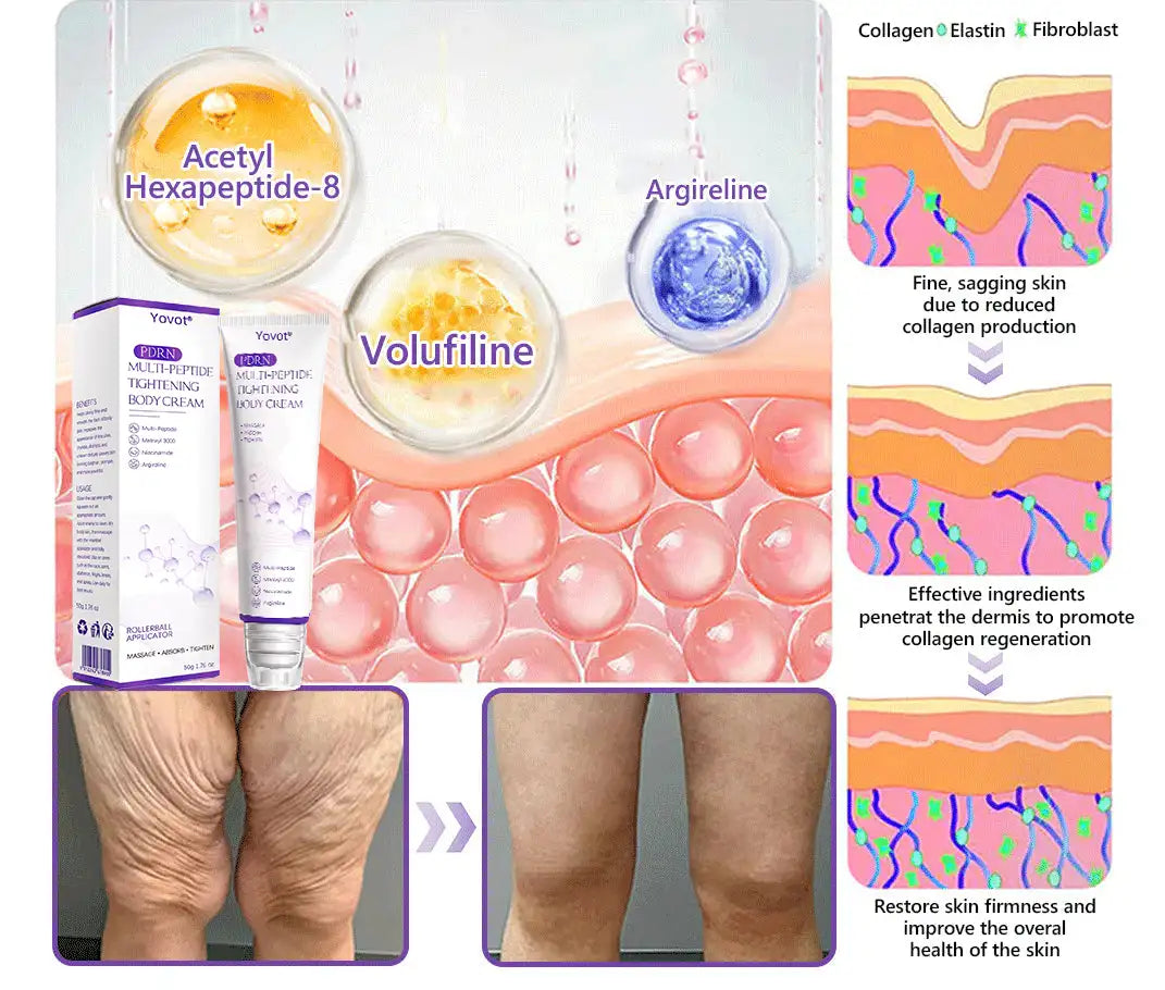 50% discount: Yovot® PDRN Multi-Peptide Massaging Body Roller Cream