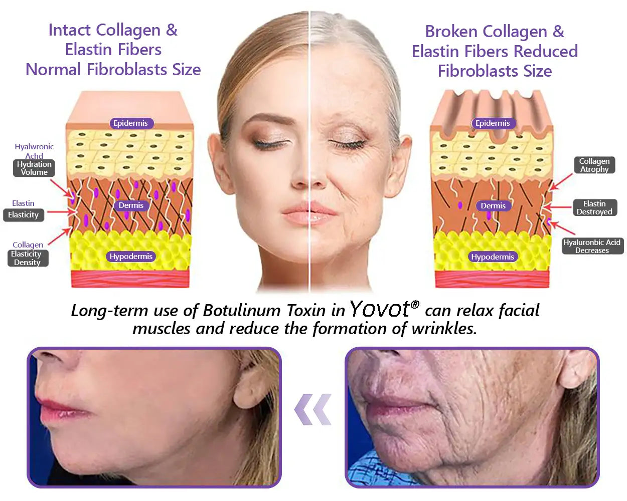 50% discount: Yovot® PDRN Multi-Peptide Massaging Body Roller Cream