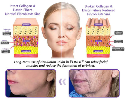 50% discount: Yovot® PDRN Multi-Peptide Massaging Body Roller Cream